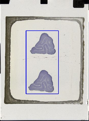 Media type: image; Special Collections 3043   shows specimen_part histological serial section;
